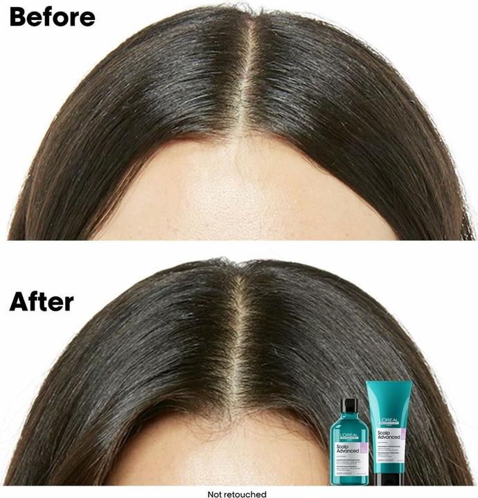 Produktbild L'Oréal Professionnel Flex Blow Dry (150 ml)