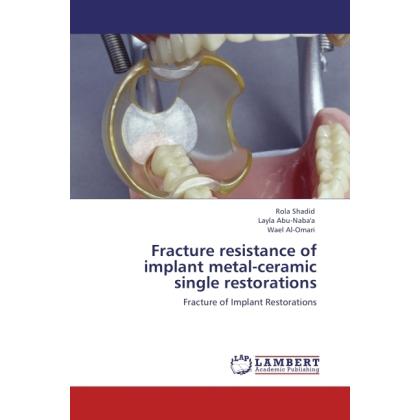 Fracture resistance of implant metal-ceramic single restorations, Fachbücher von Wael Al-Omari, Layla Abu-Naba'a, Rola S...