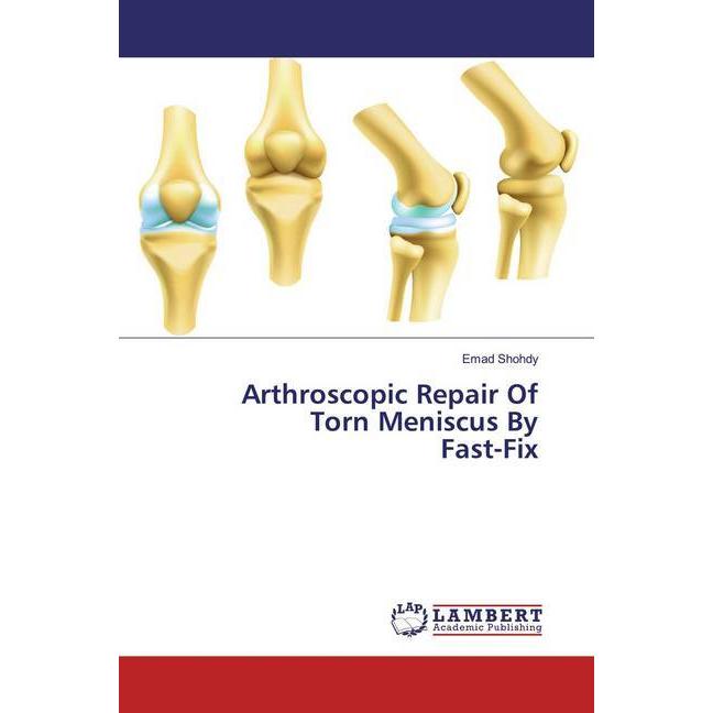 Arthroscopic Repair Of Torn Meniscus By Fast-Fix, Fachbücher von Emad Shohdy