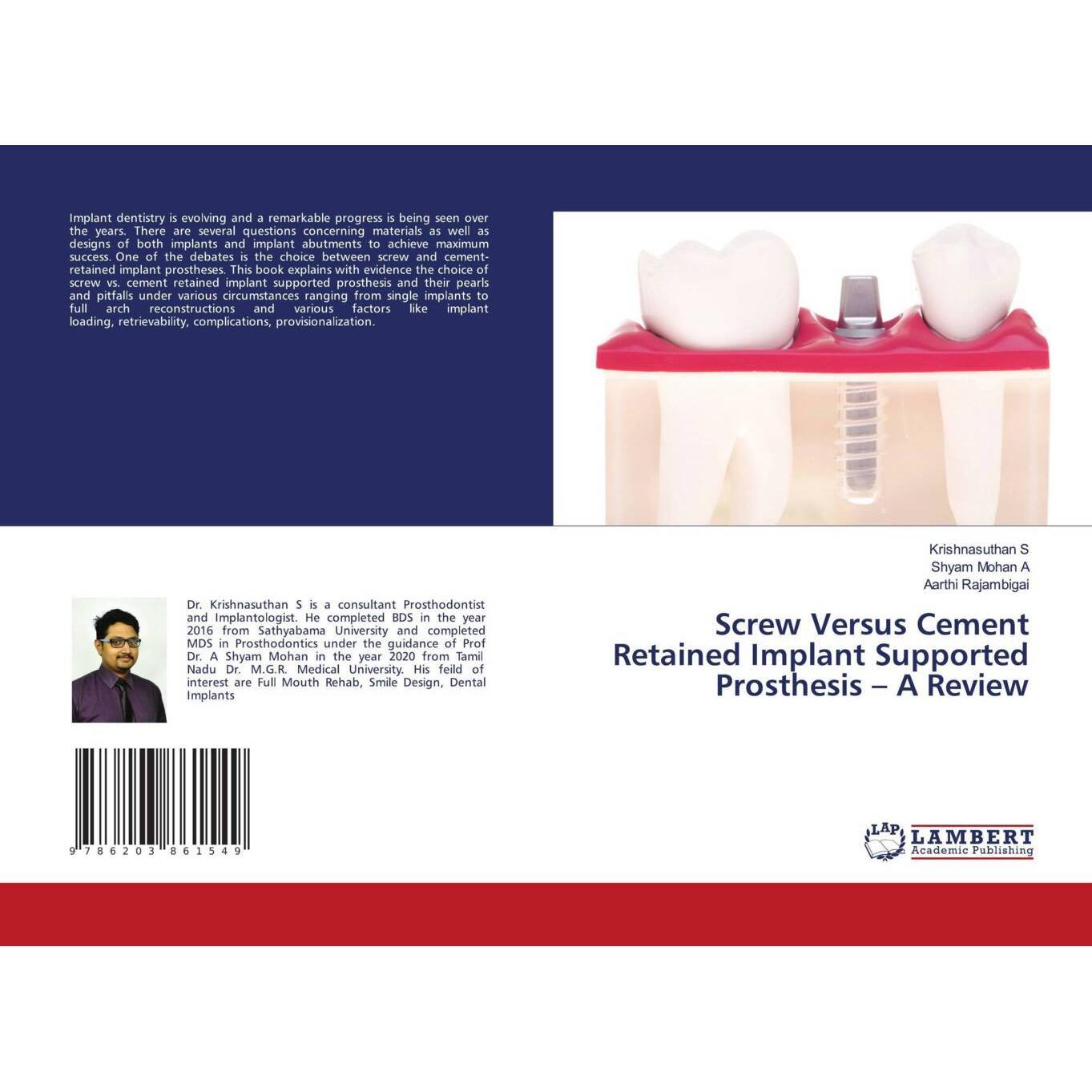 Screw Versus Cement Retained Implant Supported Prosthesis - A Review, Fachbücher von Shyam Mohan A, Krishnasuthan S, Aar...