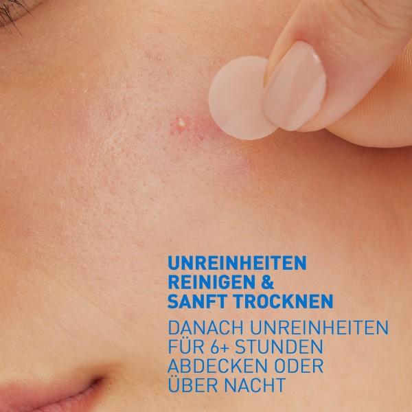 Actual product image CeraVe Anti-Unreinheiten Patches (Cleansing lotion)