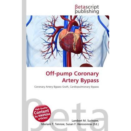 Off-pump Coronary Artery Bypass, Fachbücher von Lambert M. Surhone, Mariam T. Tennoe, Susan F. Henssonow