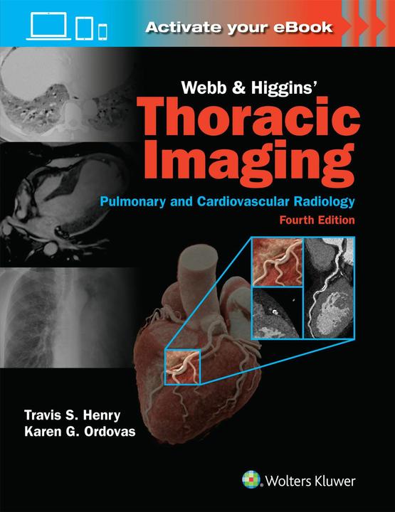 Produktbild Webb & Higgins Thoracic Imaging: Print + eBook with Multimedia (Englisch, KAREN GOMES ORDOVAS, Travis Scott Henry, 2024)