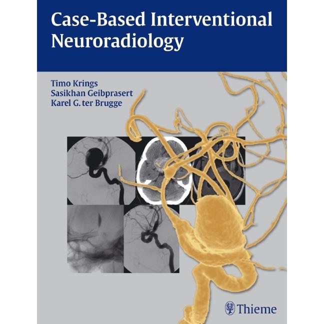 Krings:Case-Based Intervent.Neuroradio., Fachbücher von Karel ter Brugge, Sasikhan Geibprasert, Timo Krings