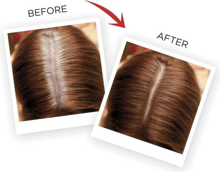 Produktbild L'Oréal Paris L ÌOrÃ©al Professionnel - Magic Retouch Instant Root Concealer Spray - (6 Mahagonibraun)