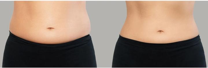 Immagine prodotto Foreo Dispositivo per Tonificazione Facciale a Microcorrente FAQ 411