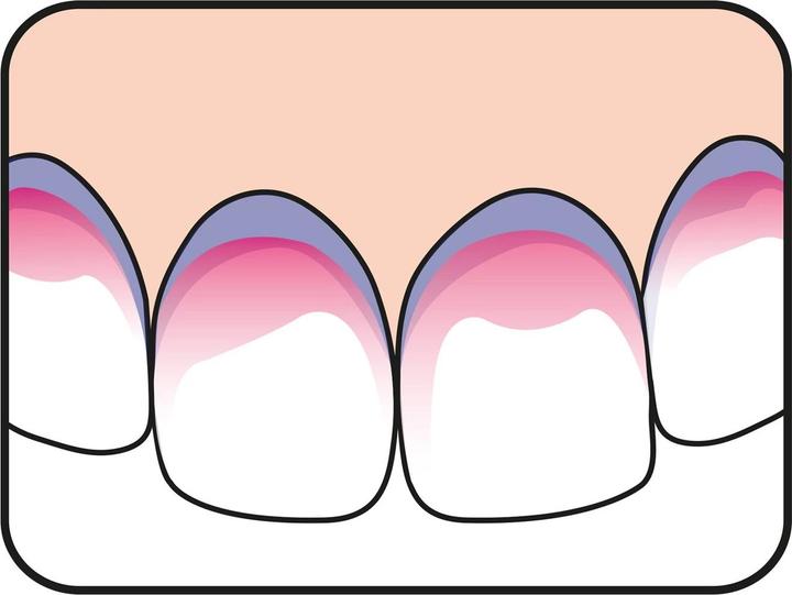 Image du produit TePe PlaqSearch