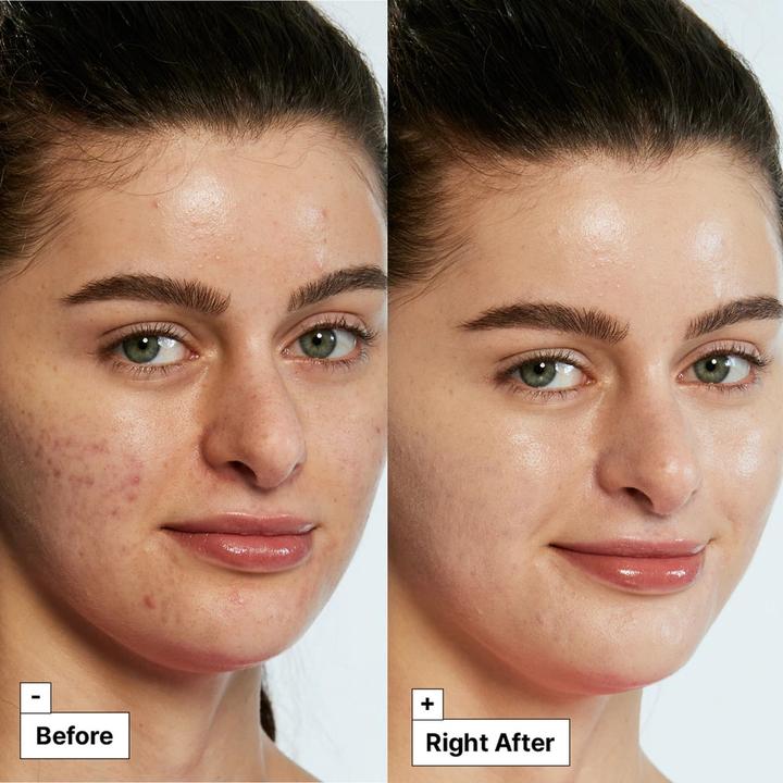 Actual product image Dr. Jart+ Cicapair Tiger Grass Colour Correcting Treatment 30 ml (30 ml)