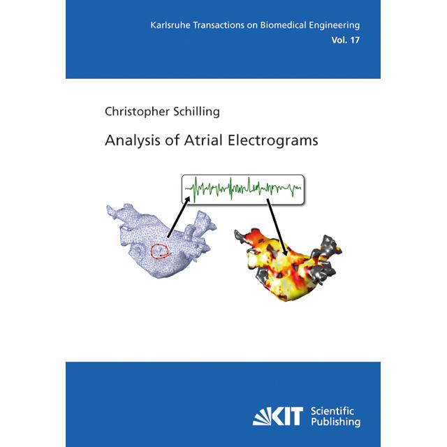 Analysis of Atrial Electrograms, Fachbücher von Christopher Schilling