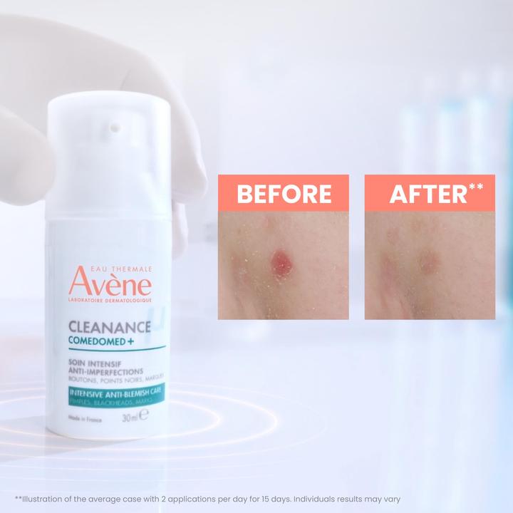 Image du produit Avène Concentré anti-imperfections Cleanance Comedomed (30 ml, Crème 24h)