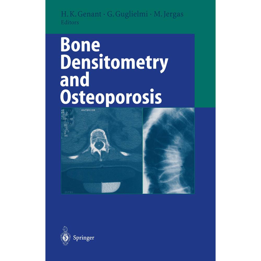 Bone Densitometry and Osteoporosis, Fachbücher von Harry K. Genant, Giuseppe Guglielmi, Michael Jergas