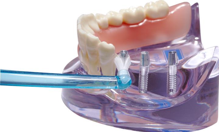 Immagine prodotto Dentaid Impianto Vitis Monotip Zb (1 x)