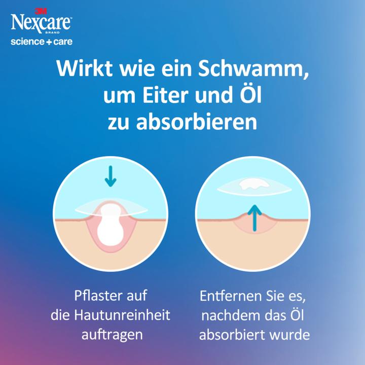 Actual product image - Nexcare acne plasters (15 x)