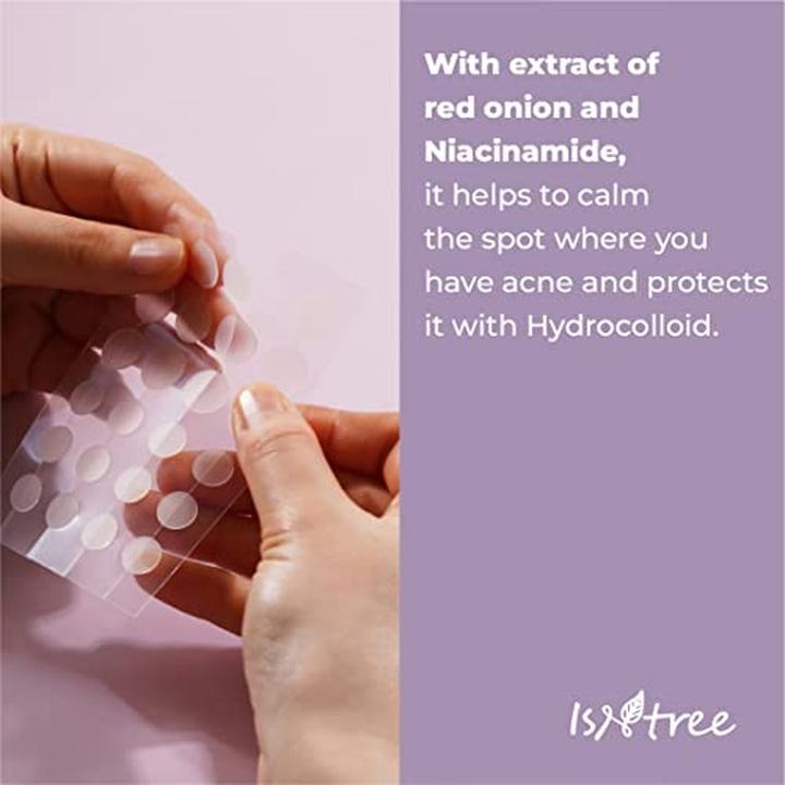 Immagine prodotto NoName Cipolla Newpair