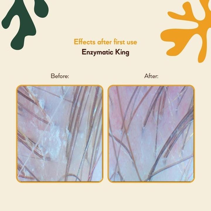 Image du produit Ha.r Try Hairtry Acid Queen Exfoliating Scalp Peel with Mandelic and Salicylic Acid Mint