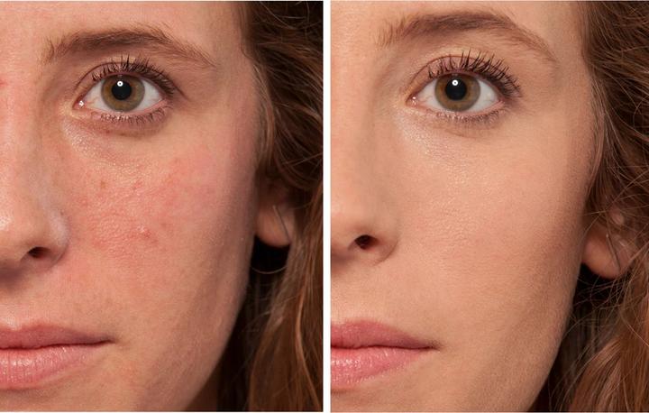 Image du produit L'Oréal Paris Correspondance parfaite (1C Rose Ivoire Ivoire)