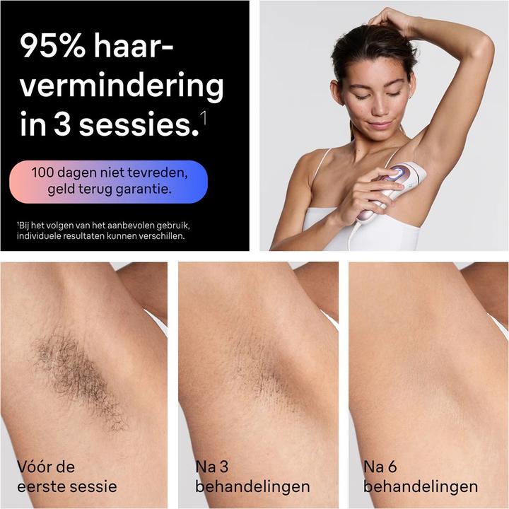 Actual product image Braun IPL Skin i·expert Pro 7