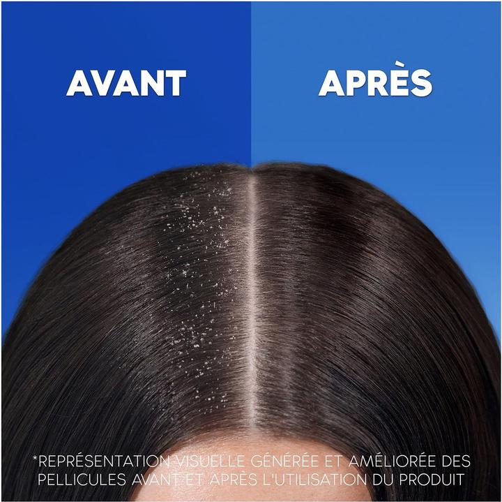 Immagine prodotto Head & Shoulders 2-in-1 Menthol Fresh, 3x270 ml (270 ml)