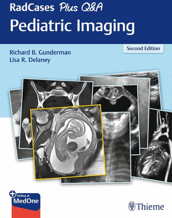 Produktbild RadCases Plus Q&A Pediatric Imaging (Englisch, Lisa R. Delaney, Richard B. Gunderman, 2019)