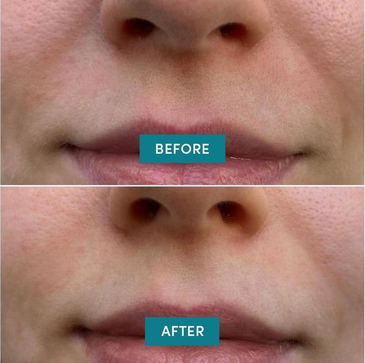 Actual product image Apricot Mundpflaster keep smiling 100 (100 x)