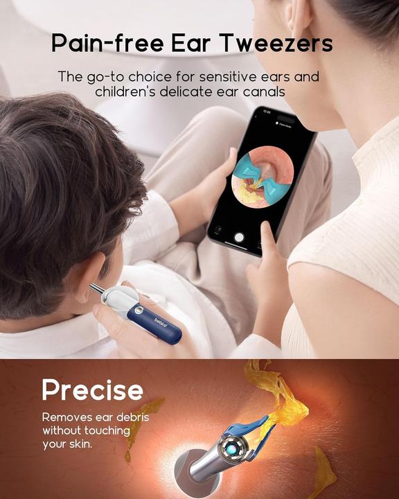 Produktbild Bebird EarSight Plus