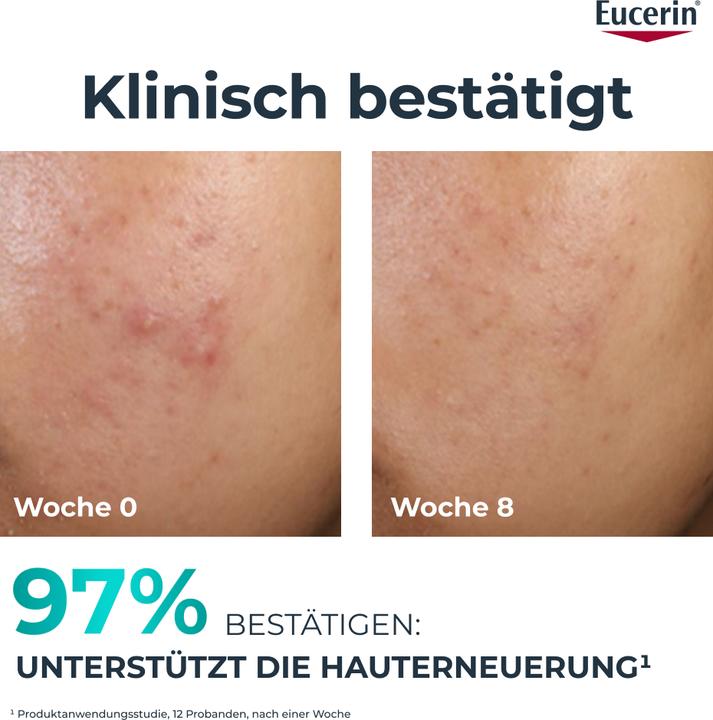 Produktbild Eucerin Dermopure Cl Peel 10 Nachtp 40ml (40 ml, Nachtcreme)