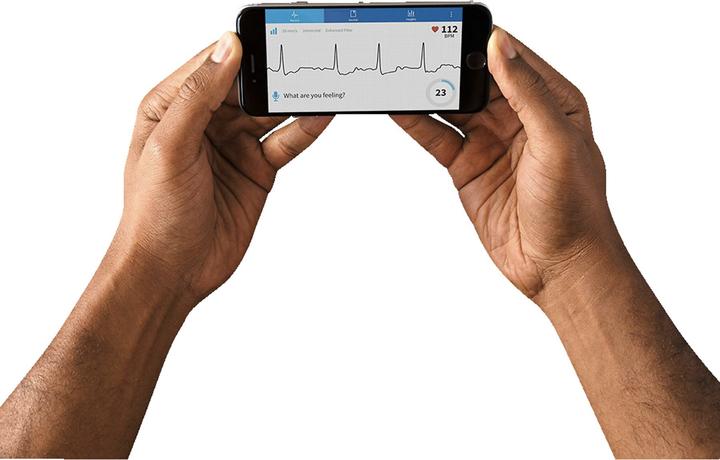 Actual product image AliveCor Ekg device Al-Kardiamobile