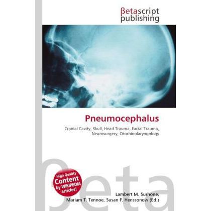 Thumbnail - Pneumocephalus, Fachbücher von Lambert M. Surhone, Mariam T. Tennoe, Susan F. Henssonow