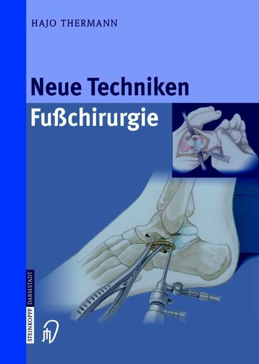 Produktbild Neue Techniken Fusschirurgie (Deutsch, Hajo Thermann, 2014)