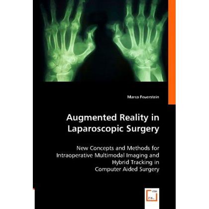 Augmented Reality in Laparoscopic Surgery, Fachbücher von Marco Feuerstein