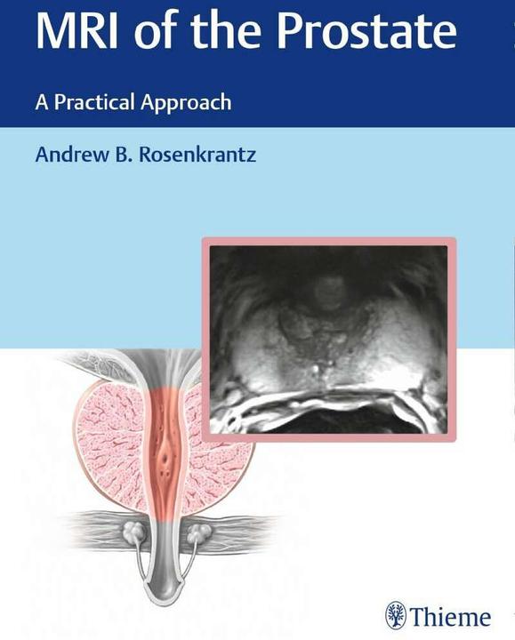 Produktbild MRI of the Prostate (Englisch, Andrew Rosenkrantz, 2017)