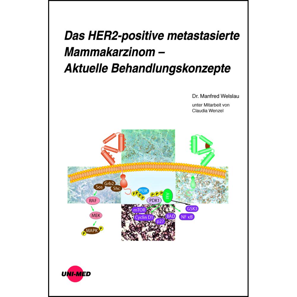 Uni-Med, Praxisbedarf, Welslau:Das HER2-positive metastasierte