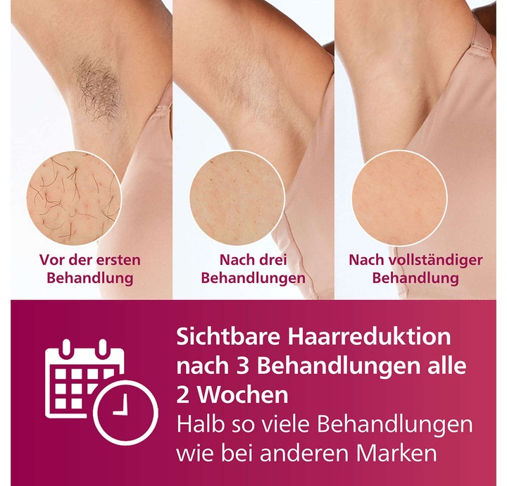 Actual product image Philips Lumea IPL Series 7000