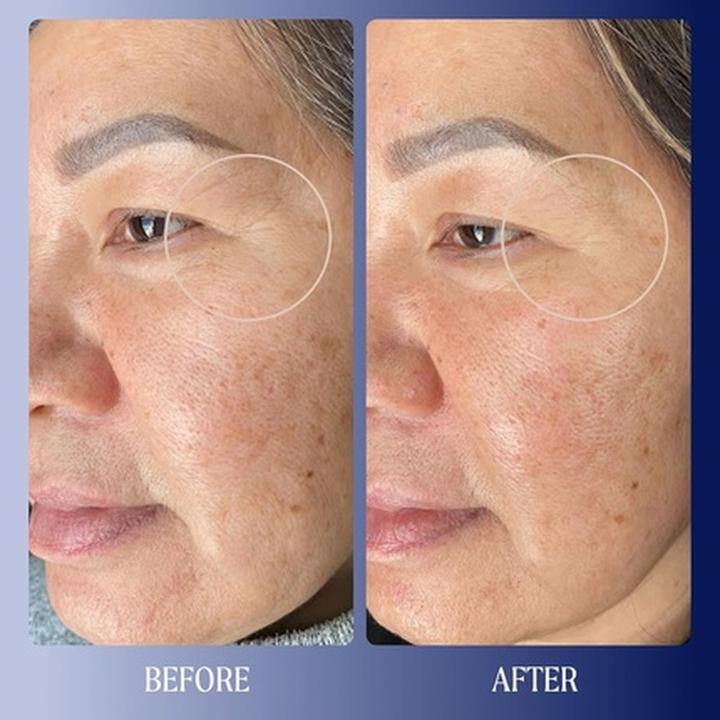 Actual product image Kinship Dreamwave 2% Bio-Retinoid Overnight Renewal Serum - Retinol (30 ml)