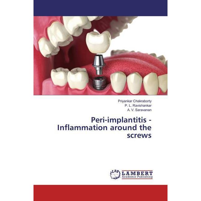 Peri-implantitis - Inflammation around the screws, Fachbücher von P. L. Ravishankar, A. V. Saravanan, Priyankar Chakrabo...