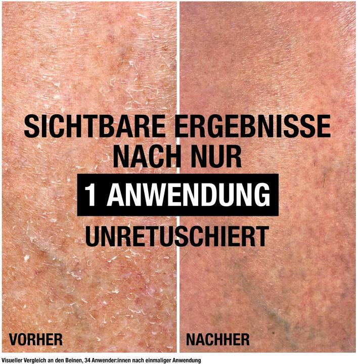 Produktbild Neutrogena Intense Repair (250 ml)