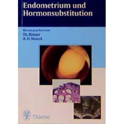 Endometrium und Hormonsubstitution, Ratgeber von Thomas Römer, Alfred O. Mück