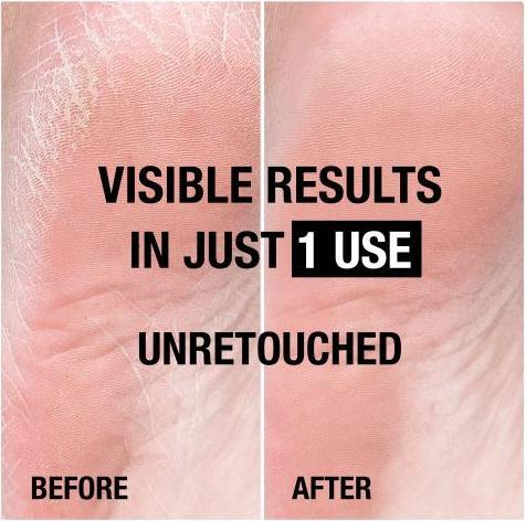 Actual product image Neutrogena Rich foot cream (Foot cream & foot gel, 100 ml)
