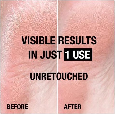 Actual product image Neutrogena Rich foot cream (Foot cream & foot gel, 100 ml)