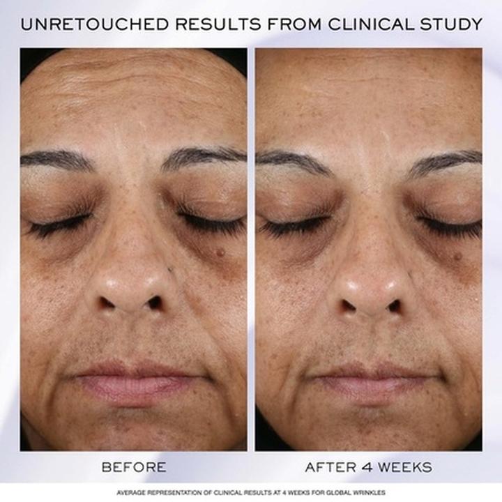 Actual product image Lancôme Renergie HPN 300 Cream 30 ml (30 ml, 24h cream)