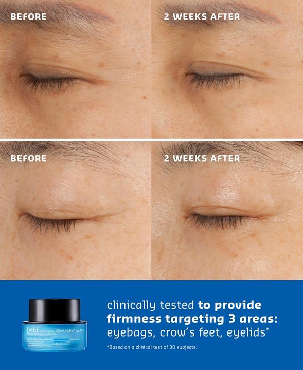 Actual product image Belif The True Cream Moisturizing Eye Bomb - Firms and Reduces Fine Lines (Eye Care Cream, 25 ml, Day + Night)