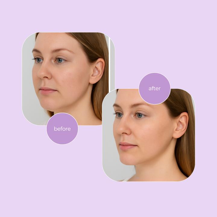 Actual product image Beldura Sculpt & Glow Beauty Roller