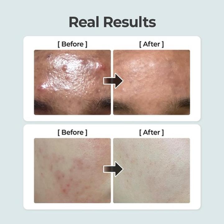 Image du produit Numbuzin No.1 Pure Full Calming Herb Toner for Acne-Prone Skin with Centella Asiatica (Lingettes nettoyantes pour le visage)