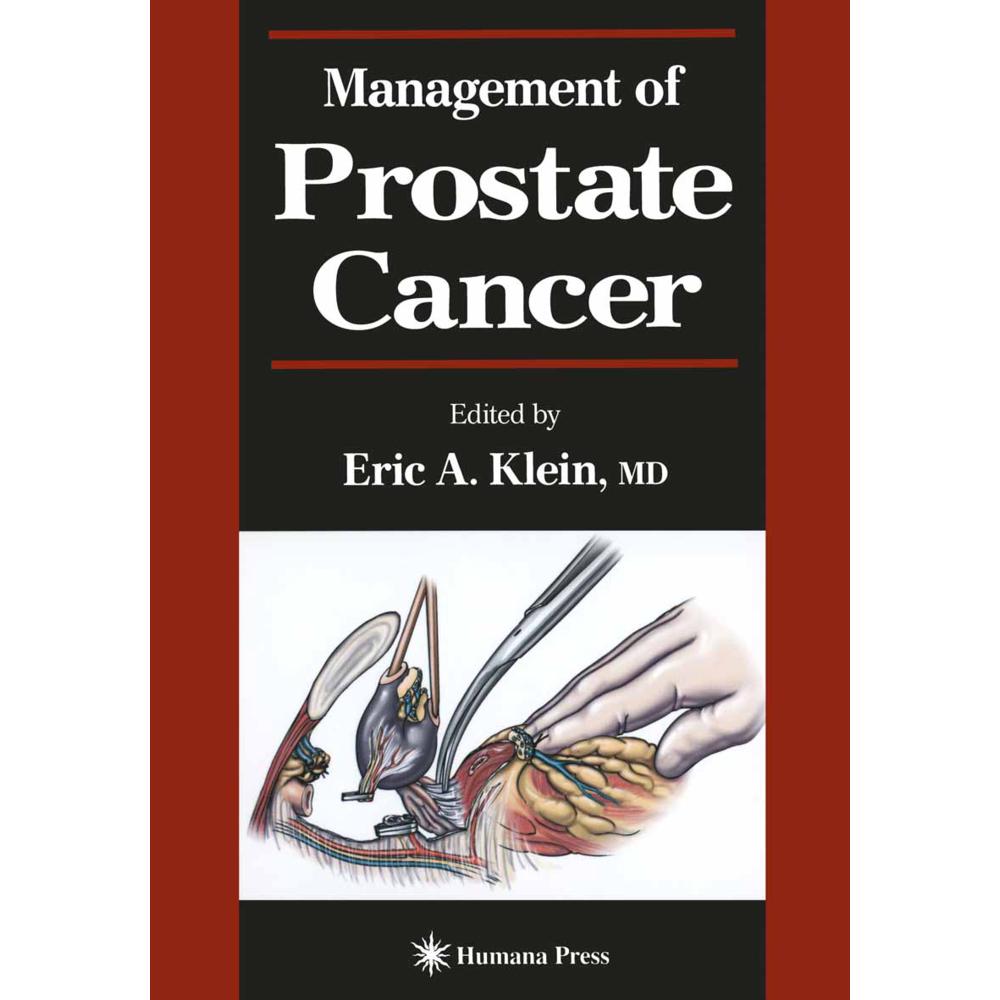 Management of Prostate Cancer, Fachbücher von Eric A. Klein