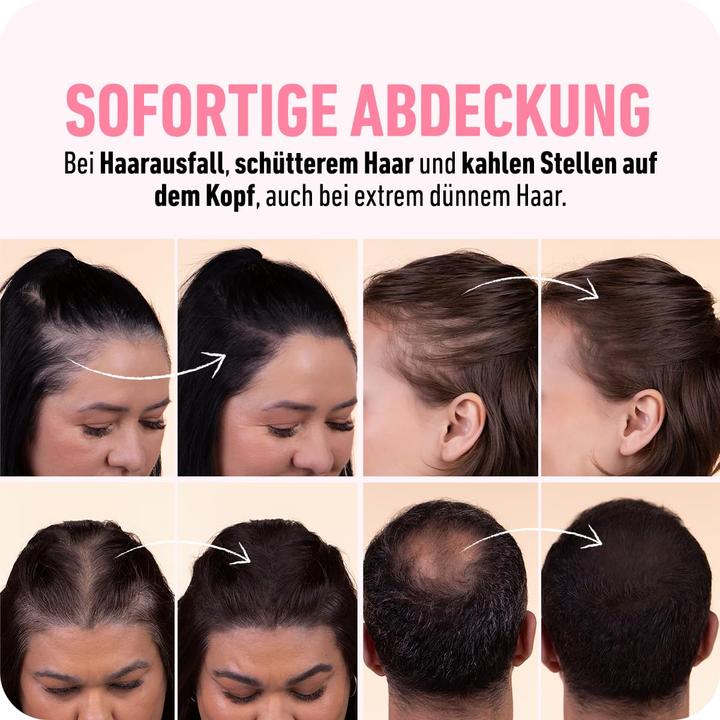 Produktbild Boldify Ansatzpuder zur Haarverdichtung und Grauabdeckung