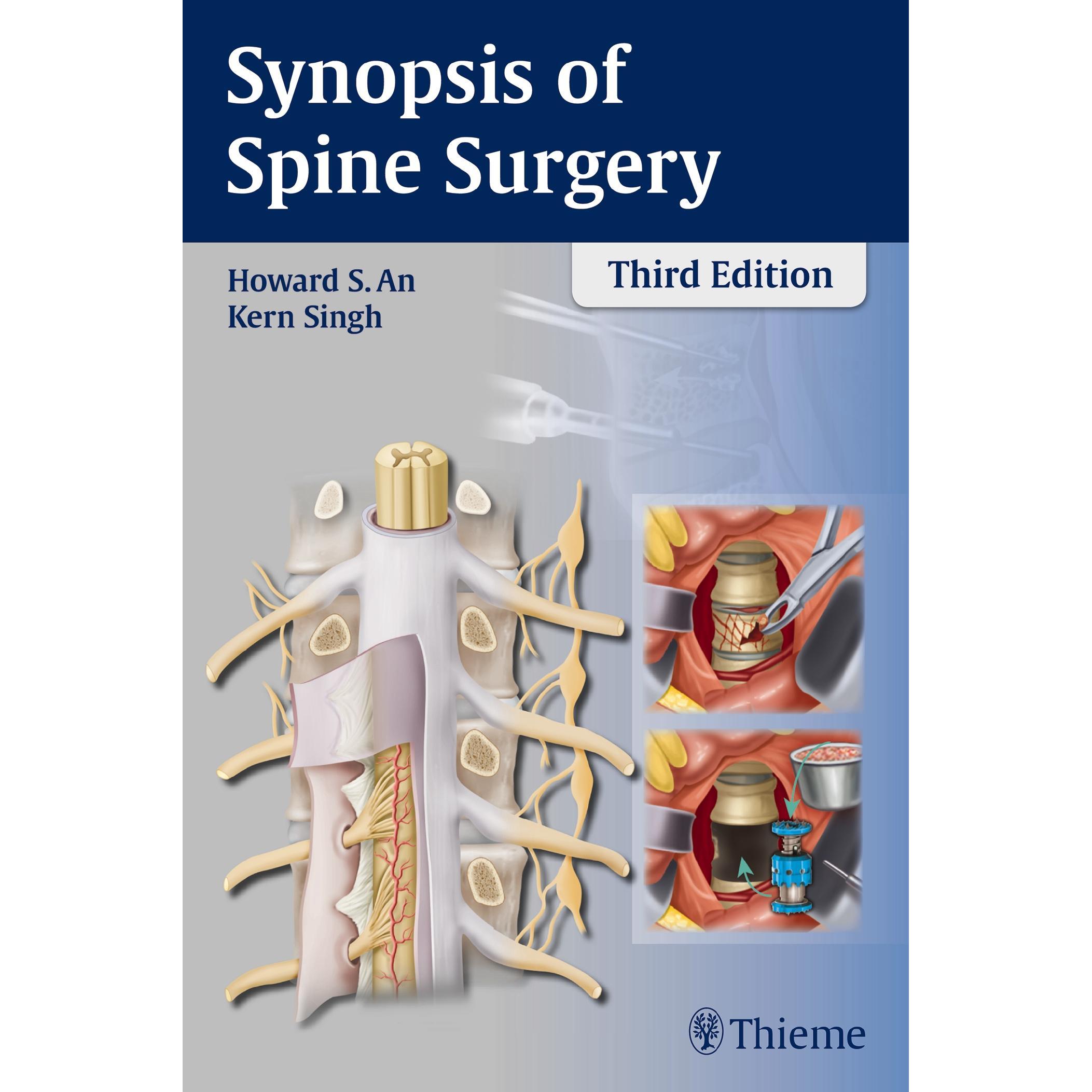 An:Synopsis of Spine Surgery, Sachbücher von Kern Singh, Howard S. An