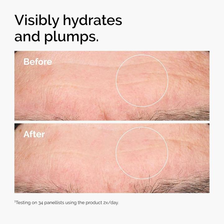 Image du produit The Ordinary Acide hyaluronique 2% + B5 (30 ml)