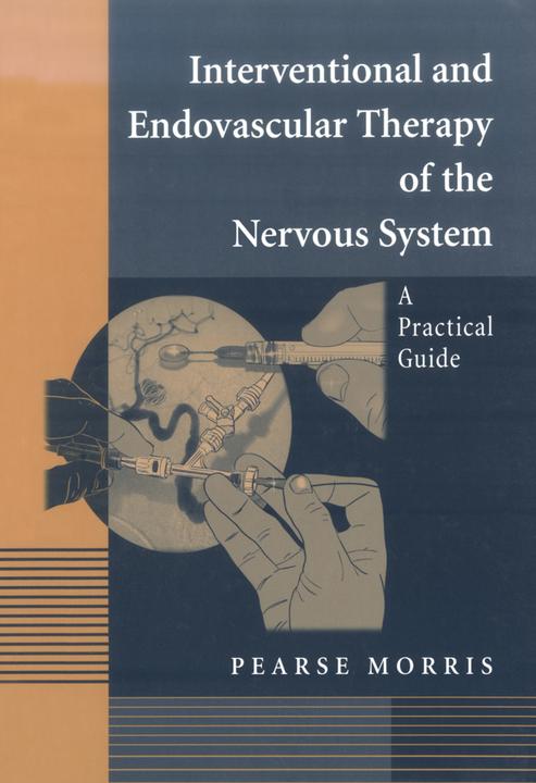 Interventional and Endovascular Therapy of the Nervous System (Pearse Morris, 2010)