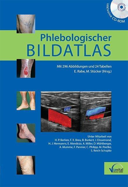 Produktbild Phlebologischer Bildatlas (Deutsch, Eberhard Rabe, Markus Stücker, 2015)