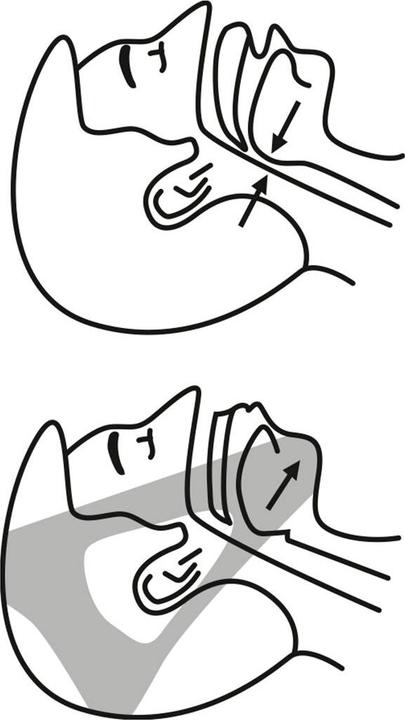 InnovaGoods Anti-Schnarch-Band Stosnore